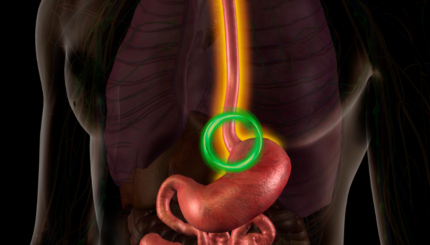 Weak Esophageal Valve - Image Showing Sphincter